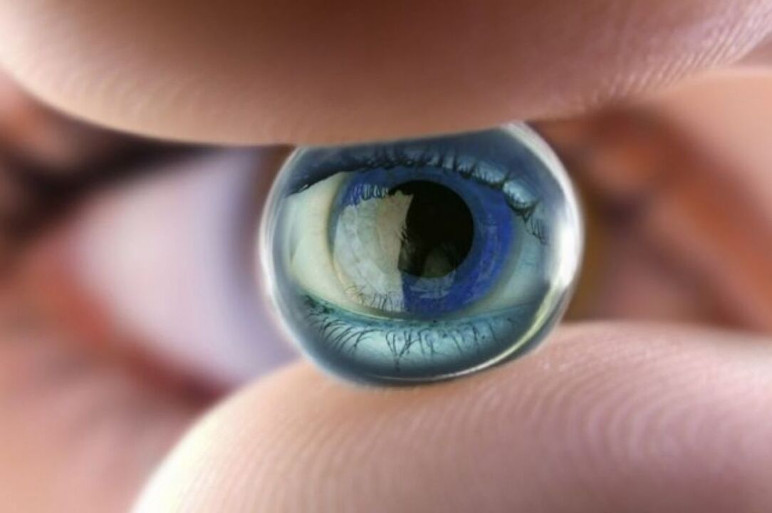 Oogcontactlenzen