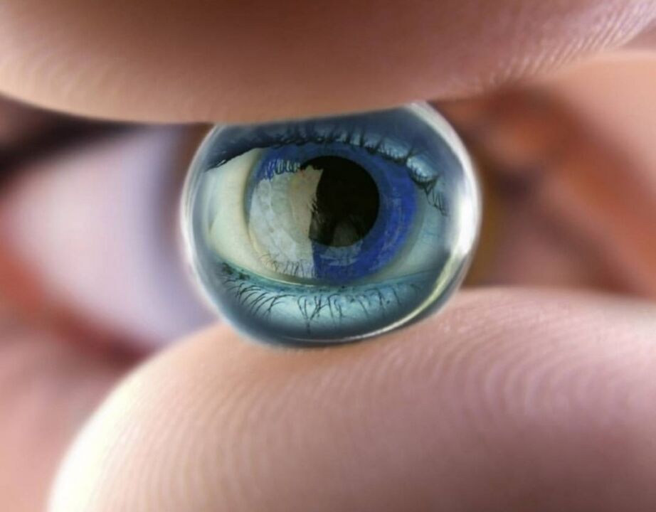 Orthokeratologische nachtlenzen zullen de voortgang van visuele beperkingen stoppen